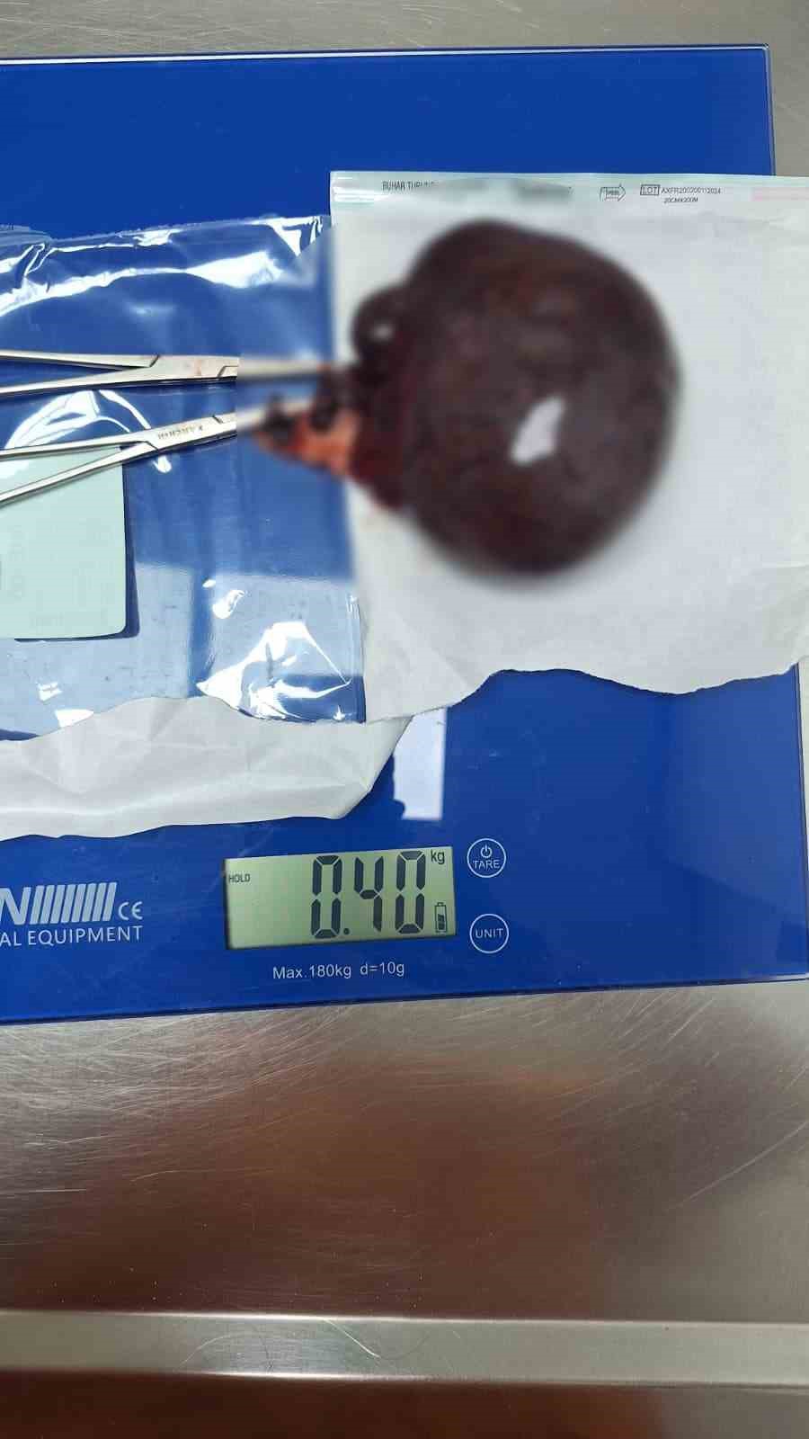 Kedinin karnından 400 gramlık kist çıktı, tedavisi yapılan kedi sahibine teslim edildi
