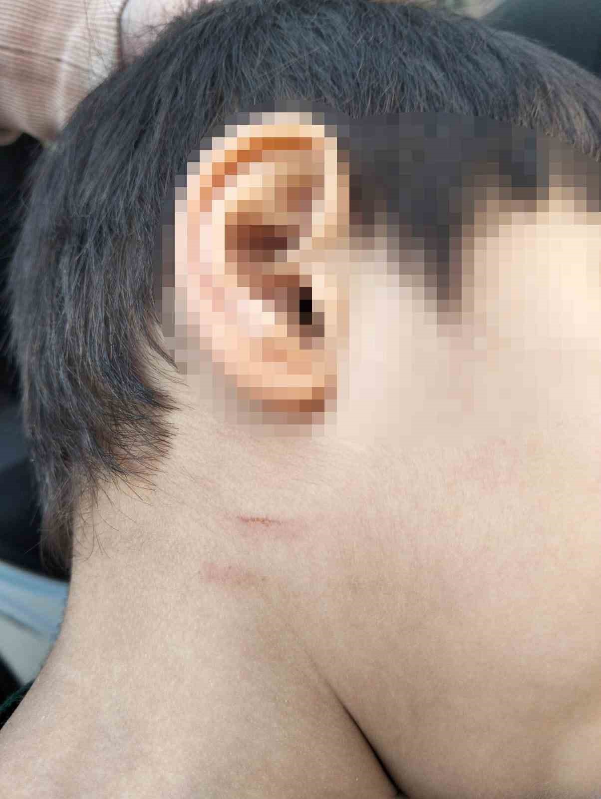 Mersin’de otizmli çocuğa şiddet kamerada: Öğretmen tutuklandı