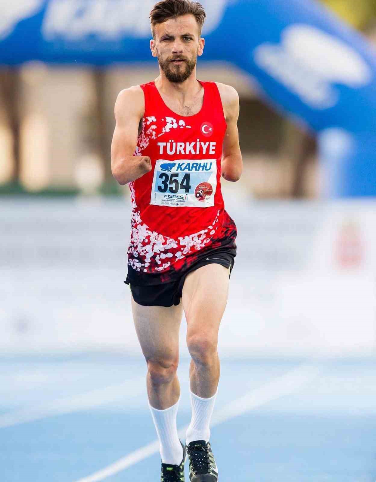 Ellerini kaybetti, hayata daha çok sarıldı