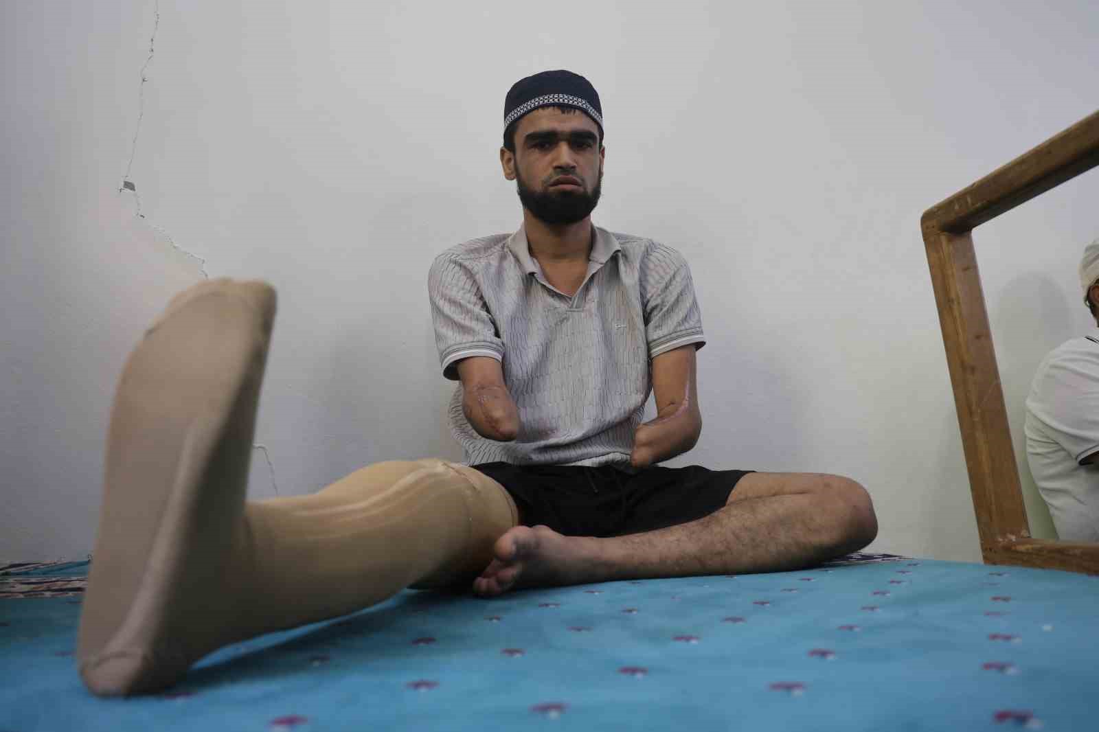 Babasına uzattığı demirin elektrik tellerine değmesiyle akıma kapılarak kollarını ve bacağını kaybeden Ahmet ibadet ederek yaşama tutundu