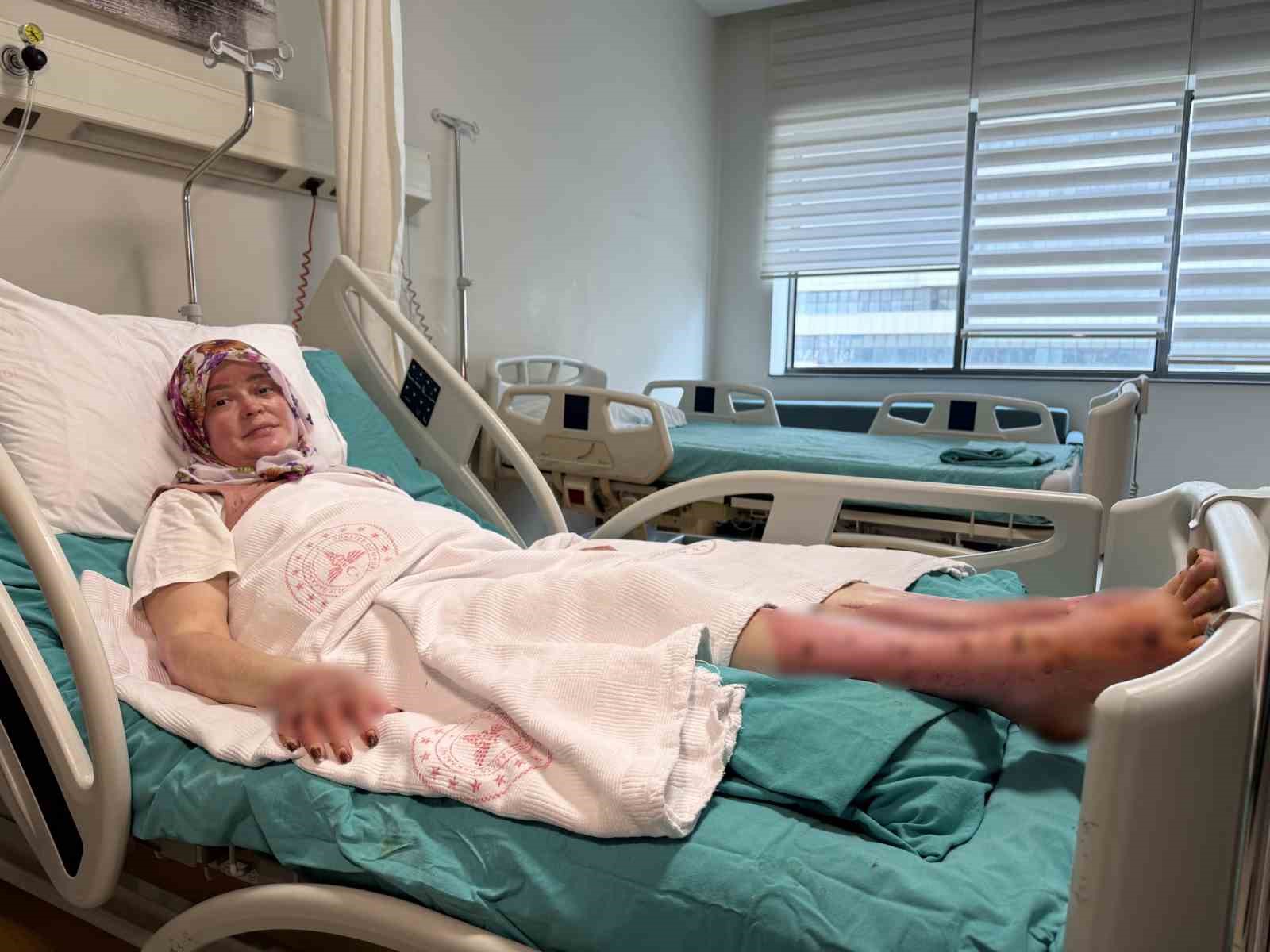 Karavandaki patlama sonrası vücudunun yüzde 70’i yandı: "Karadeniz turu yapacaktık, alev topuna döndüm"