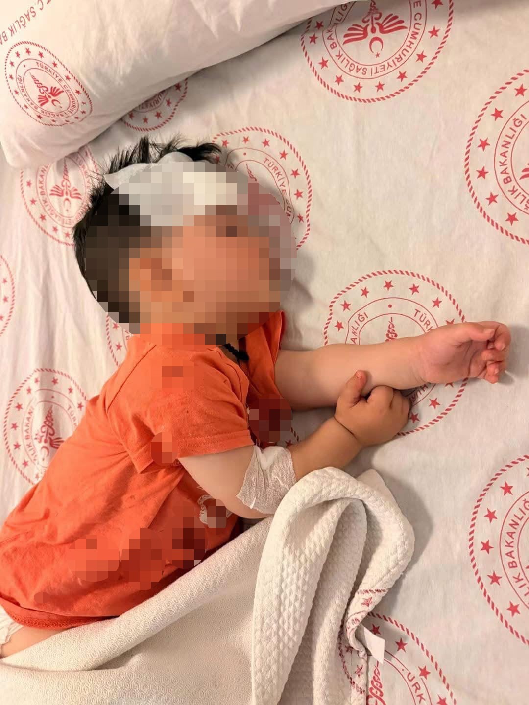 Sokak köpeklerinin saldırdığı 1 buçuk yaşındaki çocuk yaralandı