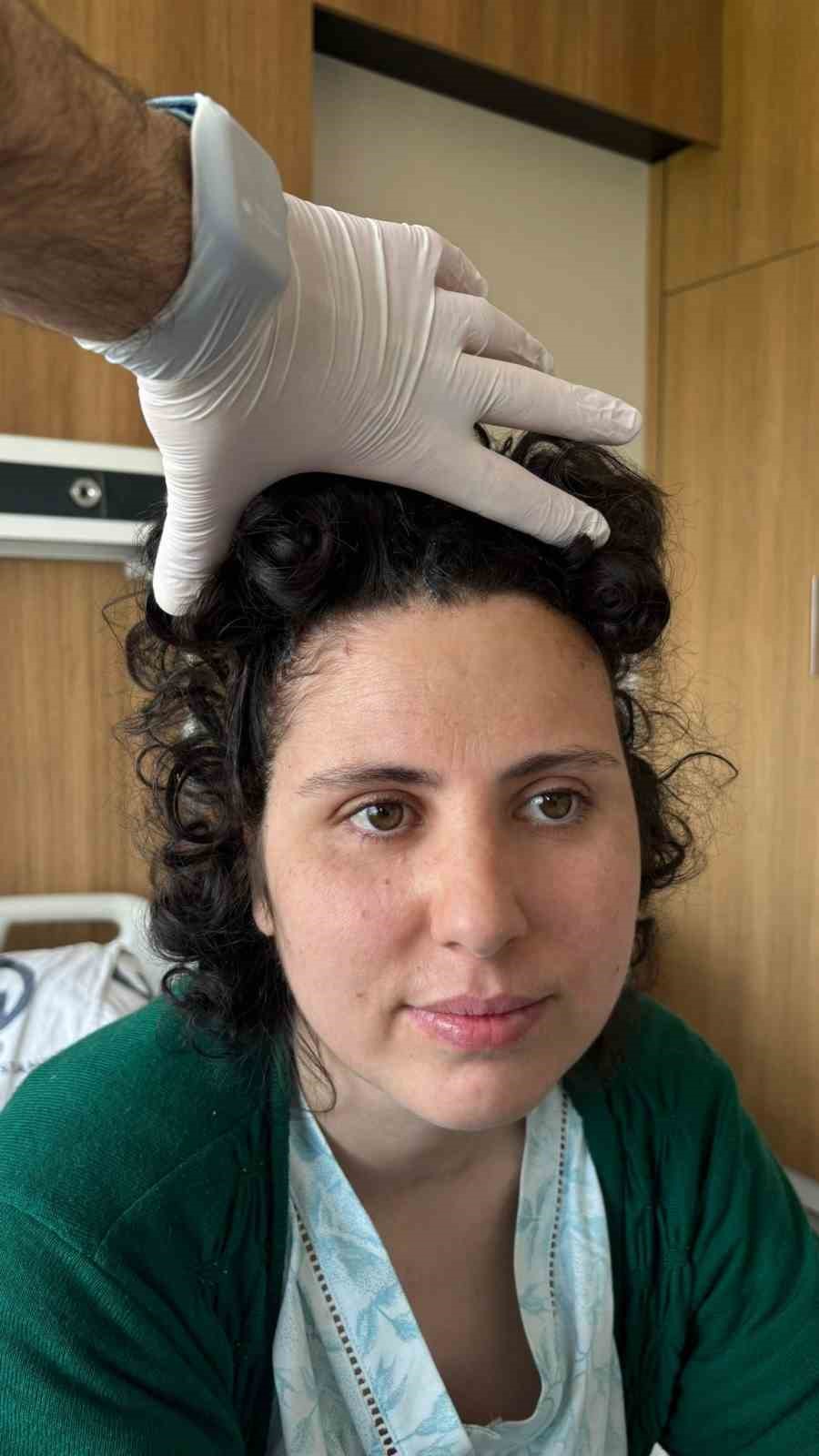 Beyin tümörü ameliyatı sonrası çöken alnı, 3 boyutlu implantla düzeltildi