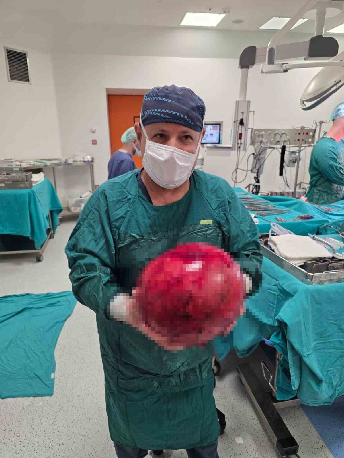 Doktorlar gözlerine inanamadı: 1,5 yıl ertelediği ameliyatta karnından dev kitle çıktı
