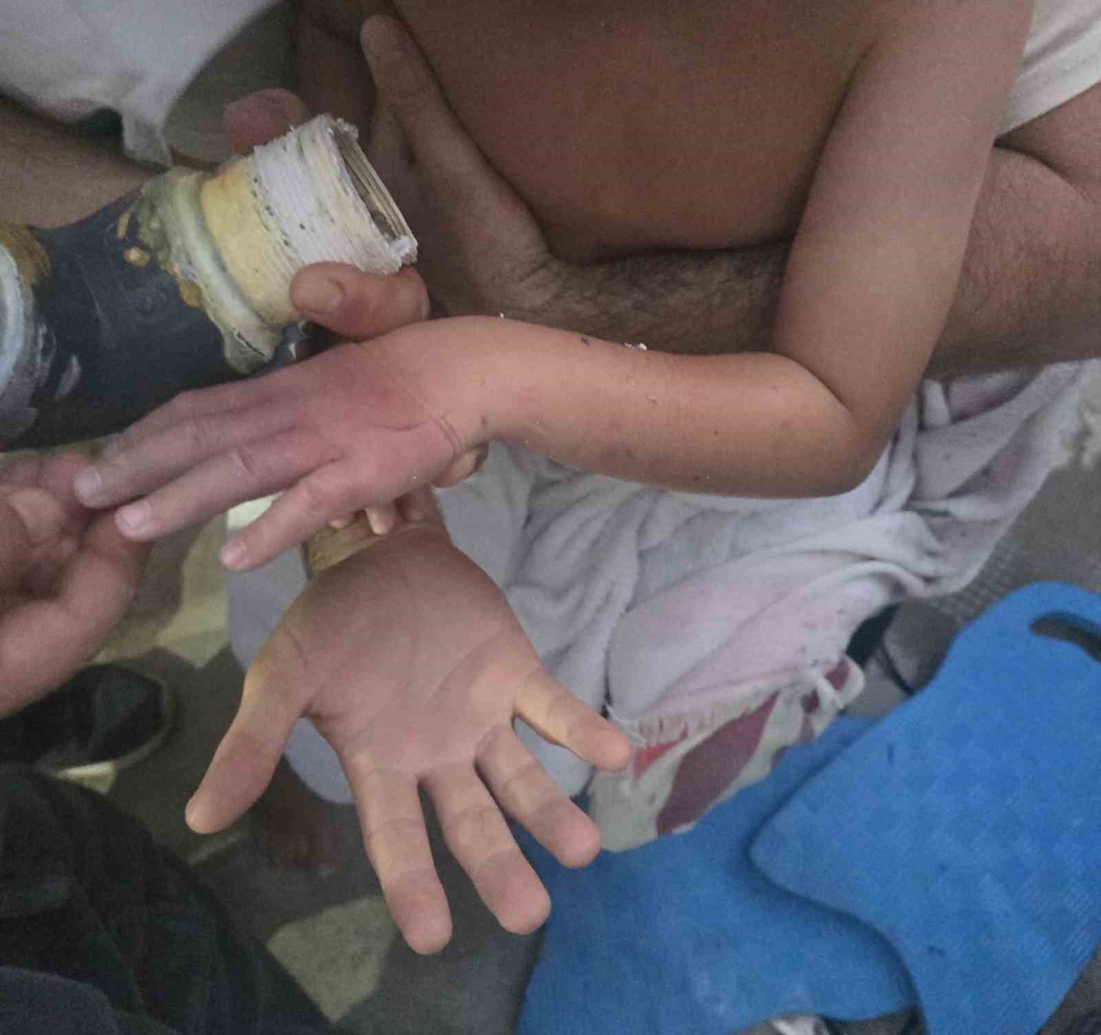 Havuzda kolu sıkışan 4 yaşındaki çocuk kurtarıldı
