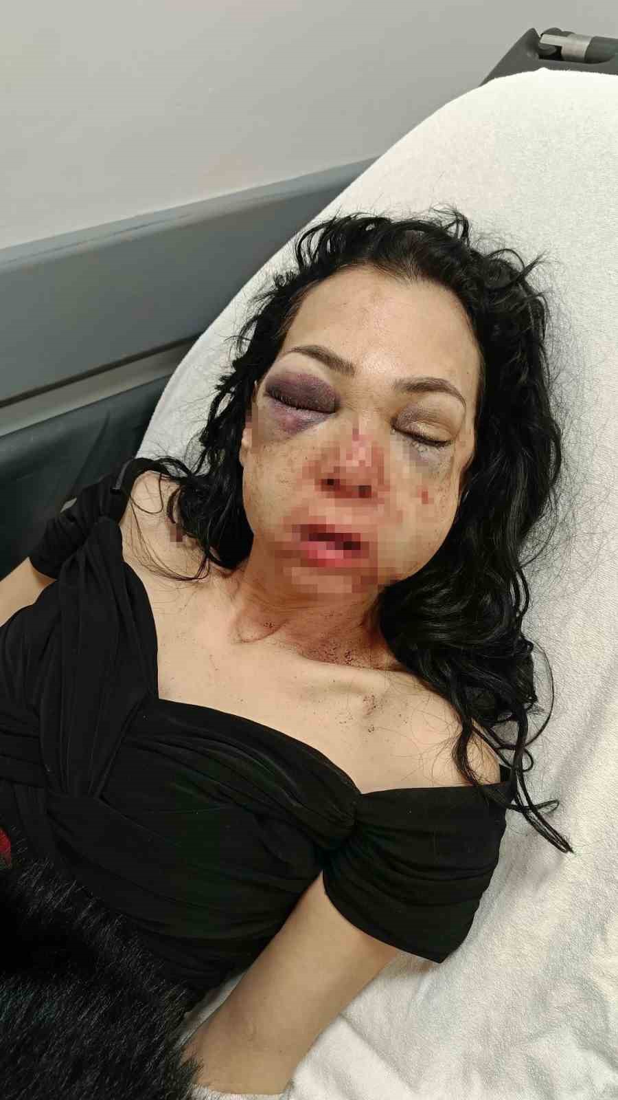 Anne ve oğlunun darbedildiği kafedeki dehşetin ilk duruşması görüldü
