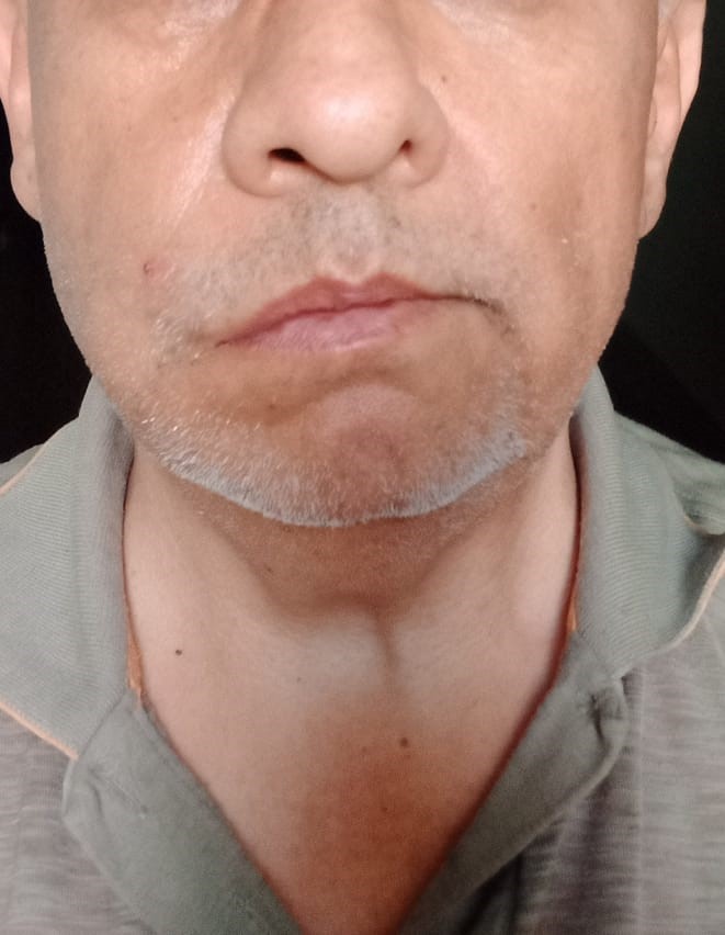 İkram kavgasının perde arkasını darp edilen doktorun avukat kızı anlattı